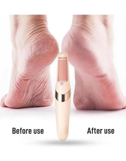 Electric Pedicure Foot File Callus Remover